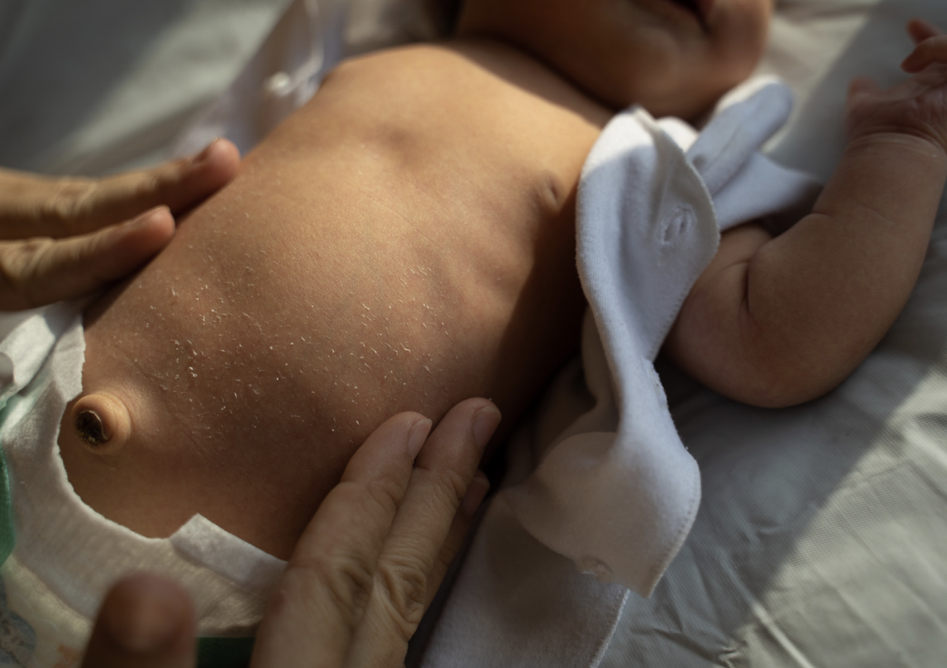 Malformasi Kongenital Saluran Cerna